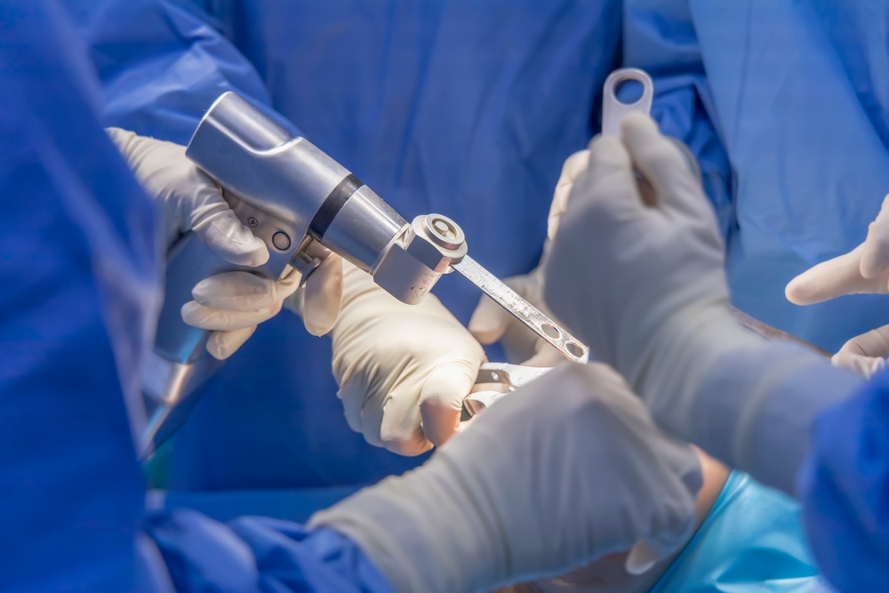 A,Doctor,Using,The,Saw,Inside,Modern,Operating,Room,While