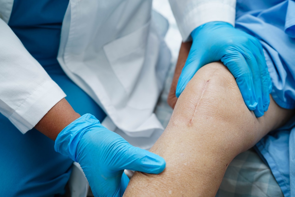 Doctor,Checking,Asian,Elderly,Woman,Patient,With,Scar,Knee,Replacement